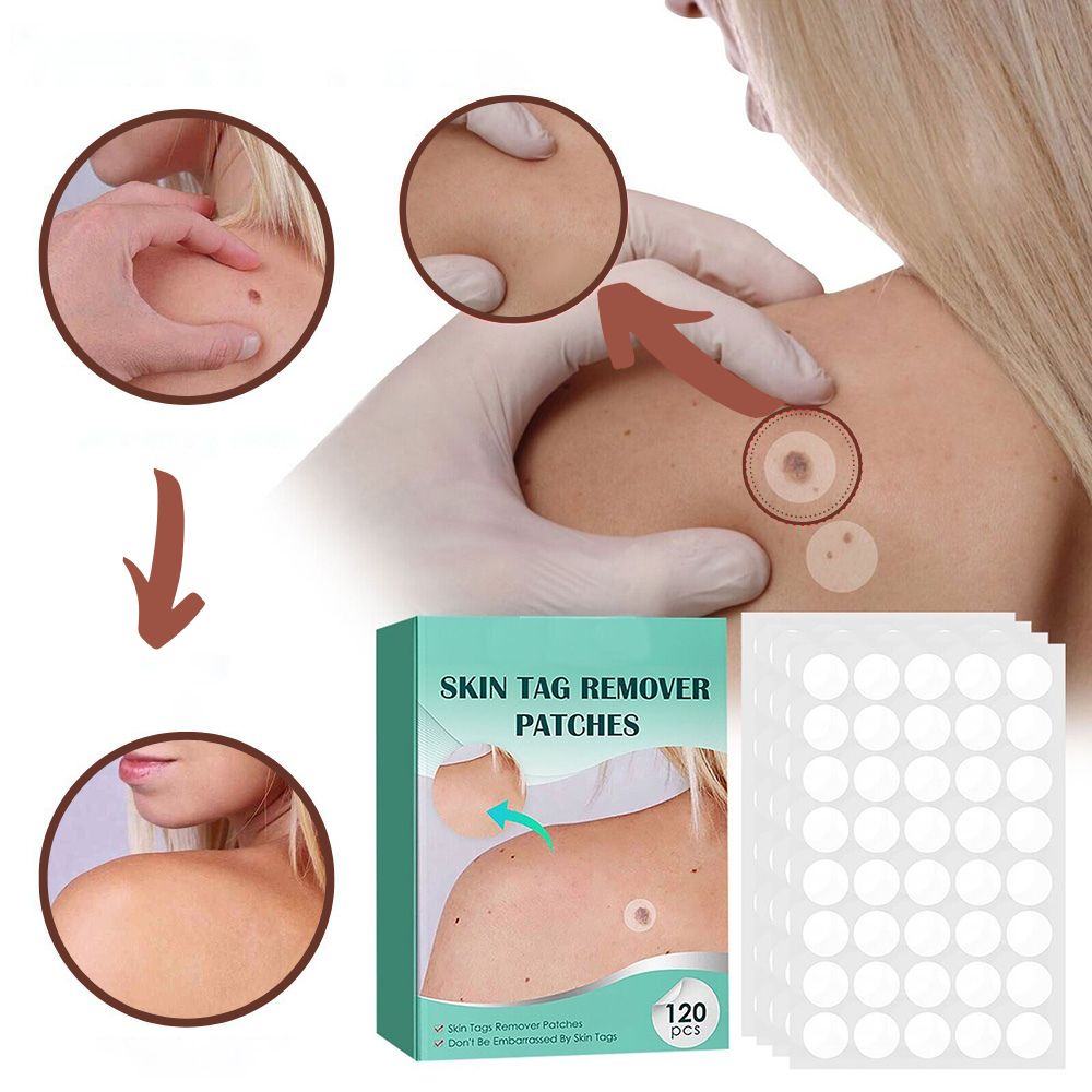 Ripob | SkinClear Hautwarzenentferner | Pflaster zur Entfernung von Hautwarzen & Warzen | Hydrocolloid-Technologie | Schmerzfrei & Diskret | Für alle Hauttypen geeignet | 144 Stück