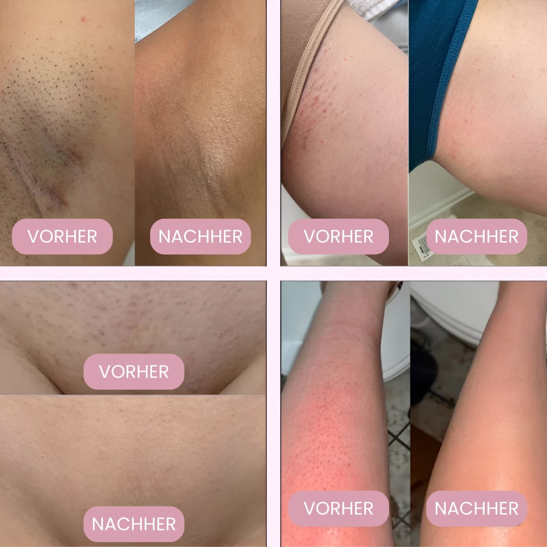 Intimrasierer für Frauen | Elektrischer Damenrasierer für intime Bereiche | Bikini-Trimmer | Femora