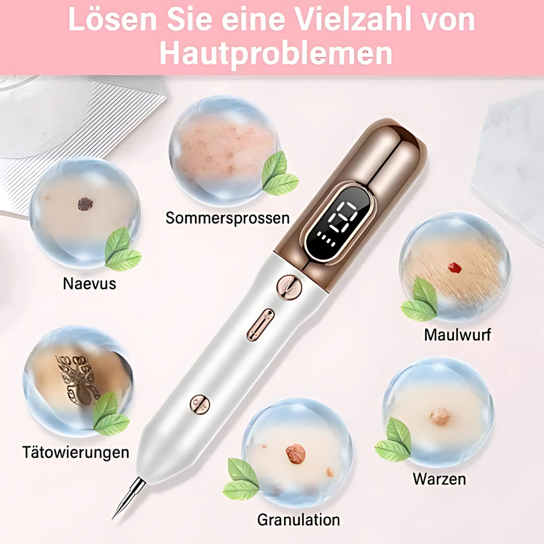 Plasma-Stift zur sicheren Entfernung von Hautmakeln