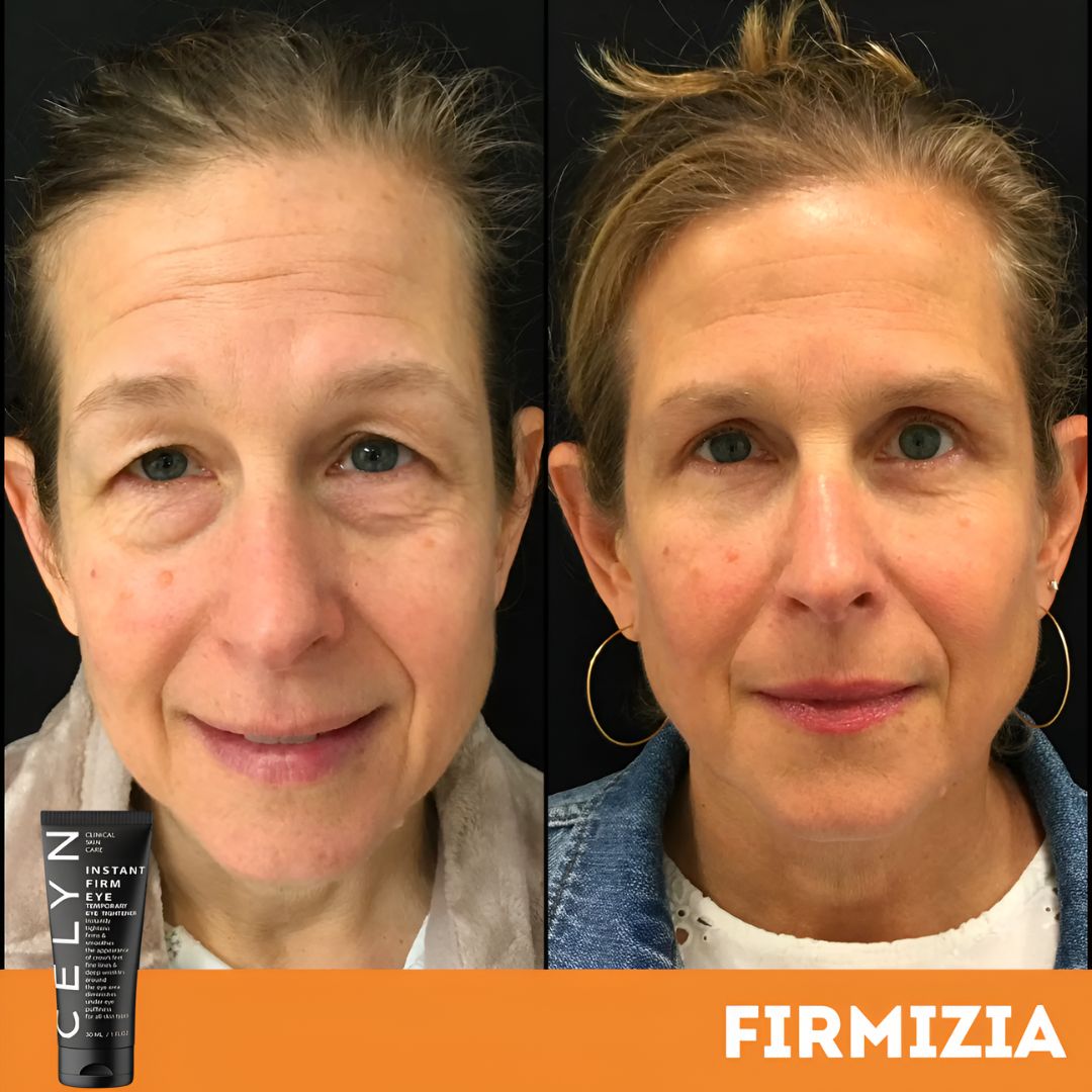 Firmizia™ - Sofortige Anti-Falten- und Augenringe-Creme